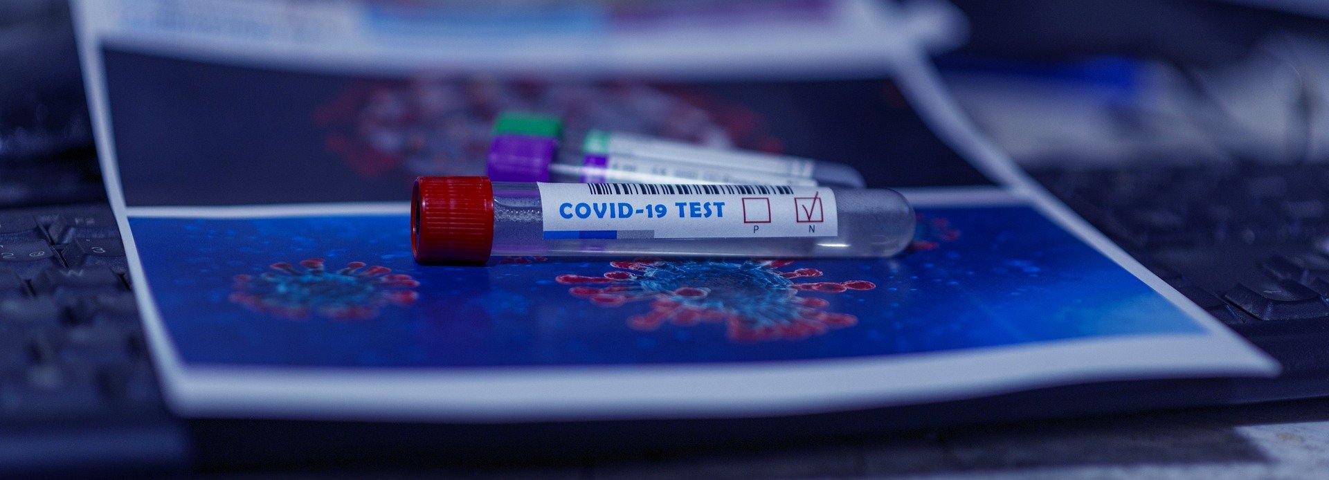 Covid-19 – derzeitiges Testangebot